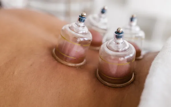 Cupping Therapy-2