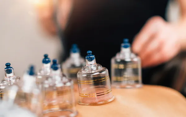 Cupping Therapy-3
