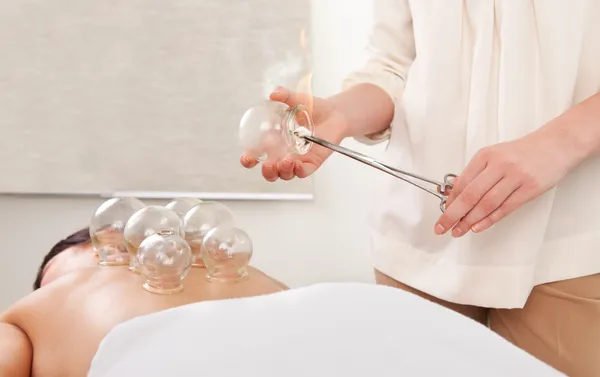 Cupping Therapy-5